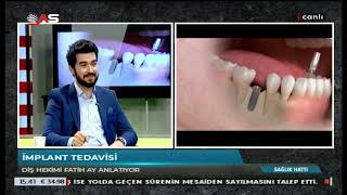 Fatih Ay-1
