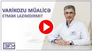 Varikozun Müalicəsi. Varikozu Müalicə Etmək Lazımdırmı? - Dr. Ceyhun Hüseynov