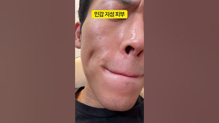 민감피부, 이중세안 절대로 매일 하지마세요.