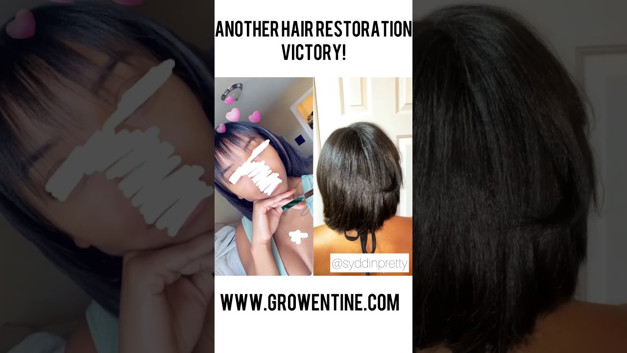 Grow Your Hair Longer, FASTER! | ‼️ SEE FIRST COMMENT ‼️