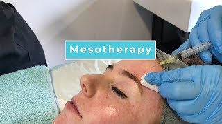 Mesotherapy With Anna