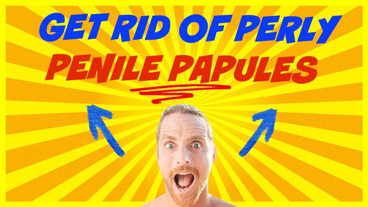 What are Pearly Penile Papules and How to Deal With Pearly Penile Papules