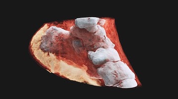 3D Color X-Rays Now Possible Thanks To CERN Technology