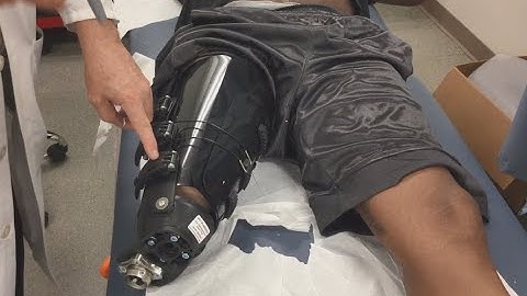 Modifying the iFIT AK Socket and Liner