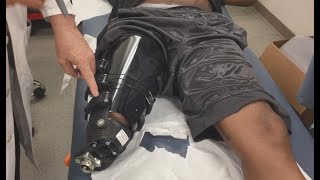 Modifying the iFIT AK Socket and Liner