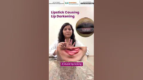 How to get rid of dark lips | Lighten dark lips | How to get SOFT & HEALTHY LIPS💋