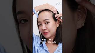 รู้ว่าดีแบบนี้ น่าจะทำตั้งนานแล้ว หน้าผากสูงเป็นปมด้อยมาตั้งแต่เด็ก ตัดสินใจปลูกผมกับ #หมอฝนBLS
