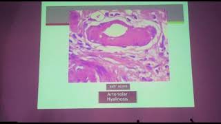 Esnt Ems Tx Day Renal Allograft Pathology Prof Wesam Ismail