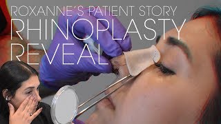 Rhinoplasty Reveal One Week After Surgery | Dr. Kian Karimi