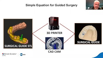 The Basics of 3D Printing Surgical Guides