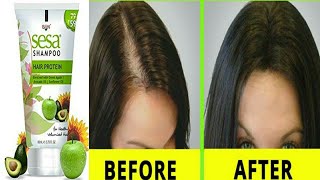 Sesa Hair Fall Control Ayurvedic Shampoo | असमय बालो का पकना बालो का झड़ना बालो का टूटना दोमुहे बाल