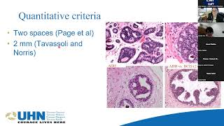 Breast Pathology community of interest meeting 8 May 2023