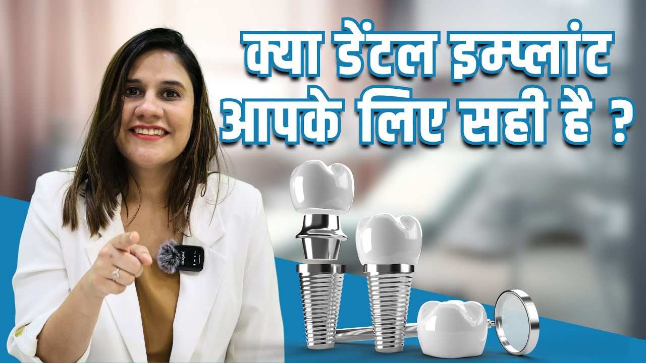 Kya Dental Implants aapke liye right choice hai? What are Dental Implants YouTube