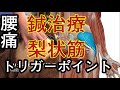 梨状筋のトリガーポイント鍼治療、腰痛、坐骨神経痛、梨状筋症候群