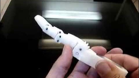 InMoov Finger Prosthetic1