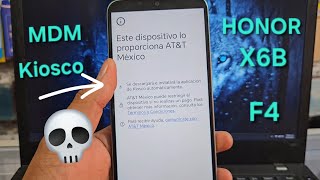 Bloqueo Kiosco MDM Honor X6b (JDY-LX3P) más F4 ➡️✅️ Chimera