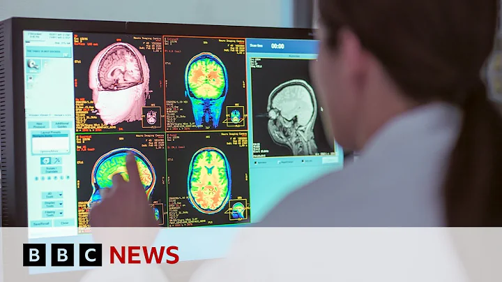 Adolescence lasts into 30s, new study shows | BBC News