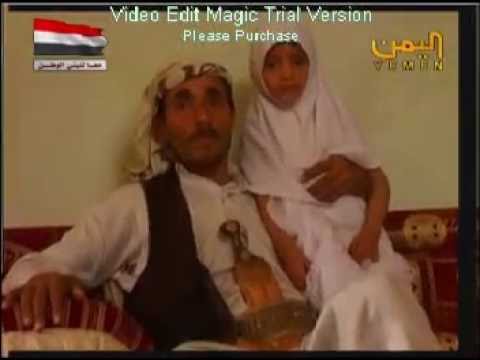 شافي نيوز حملة اسود الشرعية لطفلة نوال المصابة بسرطان