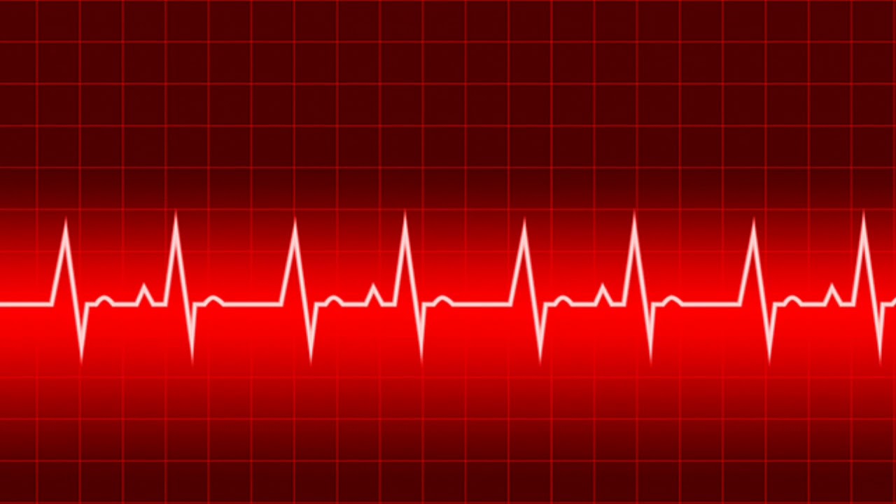 Урежает ли пульс. Кардиограмма. Кардиограмма сердца. Пульс кардиограмма. Линия сердцебиения.
