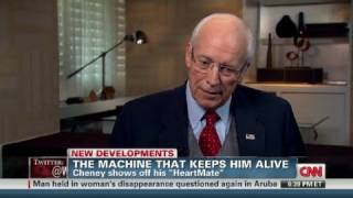 Cheney shows off his 'HeartMate'
