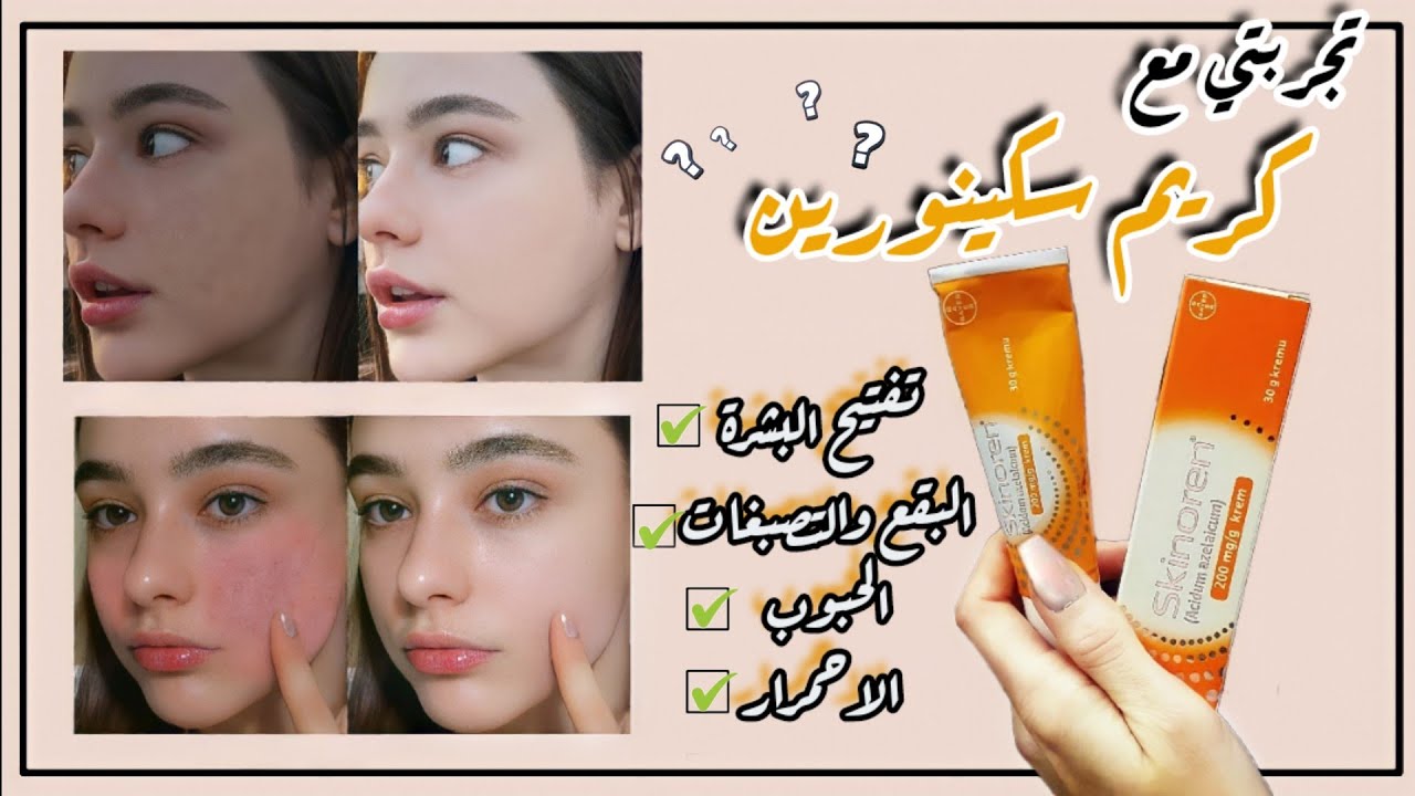 افضل كريم تقشير للبشرة | تجربتي مع مقشر سيكينورين للوجه | Skinoren