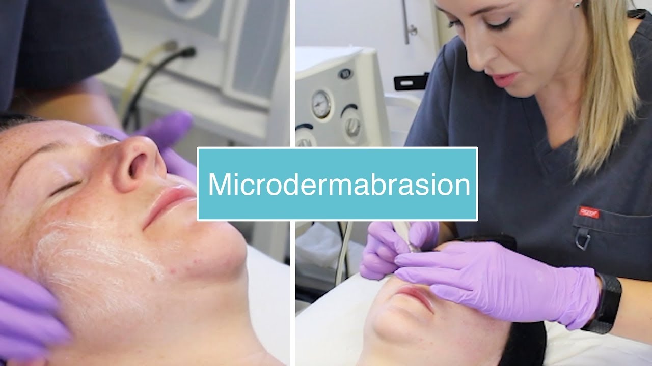 Microdermabrasion The Laser and Skin Clinic YouTube