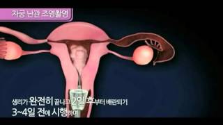 4 불임검사