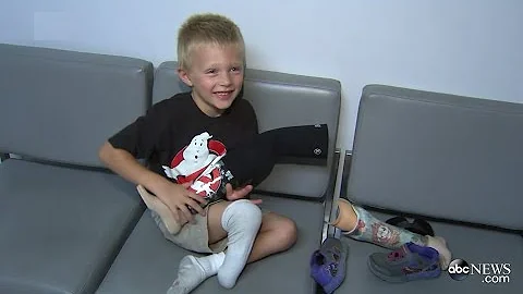 Boy Whose Prosthetic Limb Was Stolen Gets New Leg