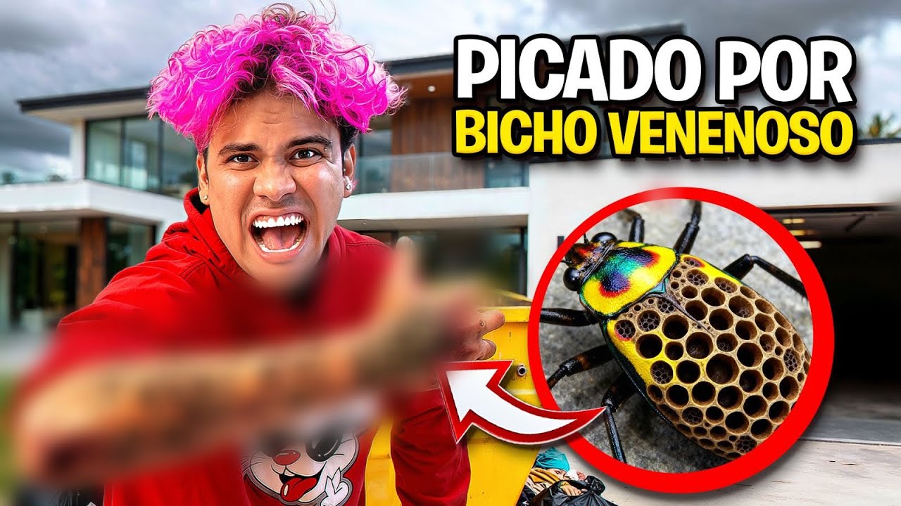 FUI PICADO POR UM BICHO MUITO VENENOSO! *fui pro hospital ?