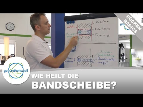 Die Bandscheibe: Wie sollte ich nach einem Bandscheibenvorfall trainieren? (Rücken-Basics)