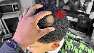 Problem: Alopecia, Remedy: Me
