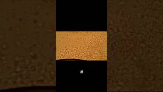 Perang ❗Bakteri di air got vs bakteri YAKULT #trending #shortsviral  #ilmu