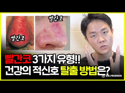 👃코가 빨개지는 딸기코의 3가지 유형 | 예방법 ! 꿀팁 공유!!