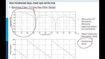 Pan-Tompkins Algorithm