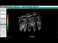 Ez 3di  logiciel vatech  synergy dental