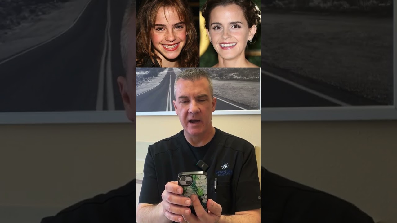 Miley Cyrus & Emma Watson’s Teeth – The TRUTH Revealed by a Dentist!