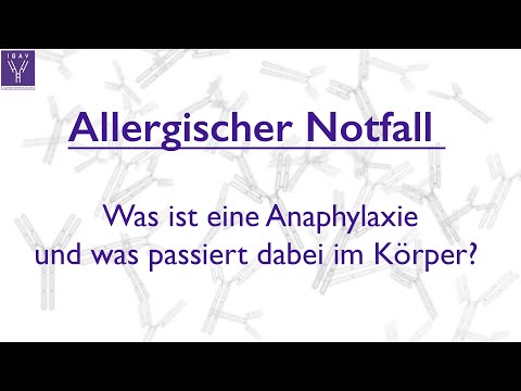 Was ist eine