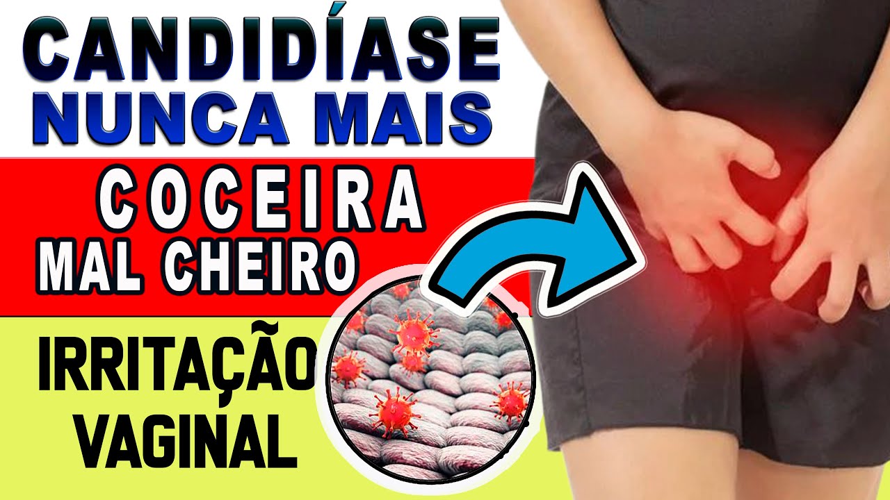 Acabe com a CANDIDÍASE / COCEIRAS / MAU CHEIRO / ARDÊNCIA / INCHAÇO ...
