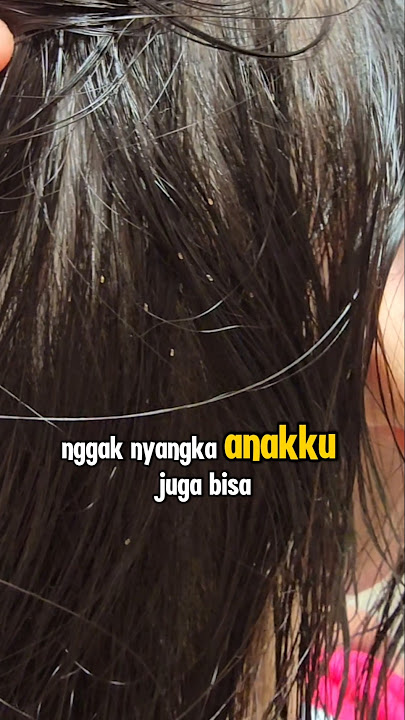 cara pakai peditox, cara ampuh untuk kutu rambut #peditox #kuturambut