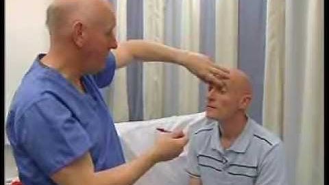 MRCP PACES 3,4,,6 Crania Nerves