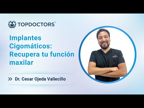 Implantes Cigomáticos: Recupera tu función maxilar