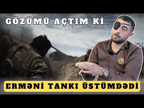 Ağır Yaralanaraq Əsir Düşən 43 Er@məni Leş@i Olan | Gizir Ələkbərov Ömər 1-ci Bölüm