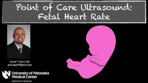 Measuring Fetal Heart Rate with M-Mode