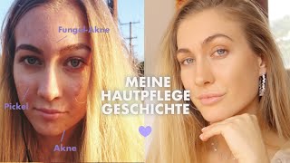 Meine nicht-gesponserte HAUTPFLEGEROUTINE + GESCHICHTE ♥