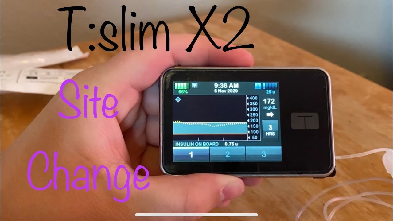 T:slim X2 Site Change