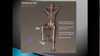 Meniscus Anatomy, Tears, and Meniscectomy