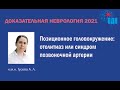 Позиционное головокружение: отолитиаз или синдром позвоночной артерии