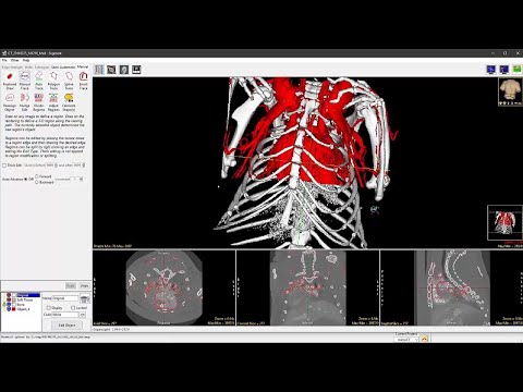 Analyze 14.0 Overview