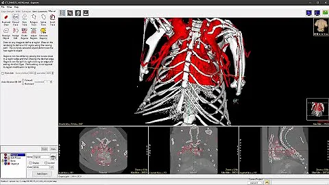 Analyze 14.0 Overview