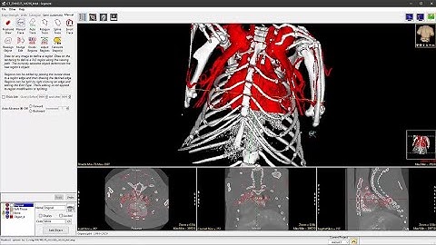 Analyze 14.0 Overview